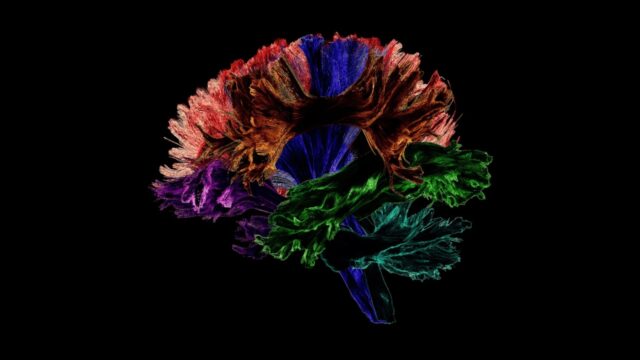Colorful pathways of the white matter by Francois Rheault, Sherbrooke University, in The Neuro Bureau Brain Art Competition 2018.